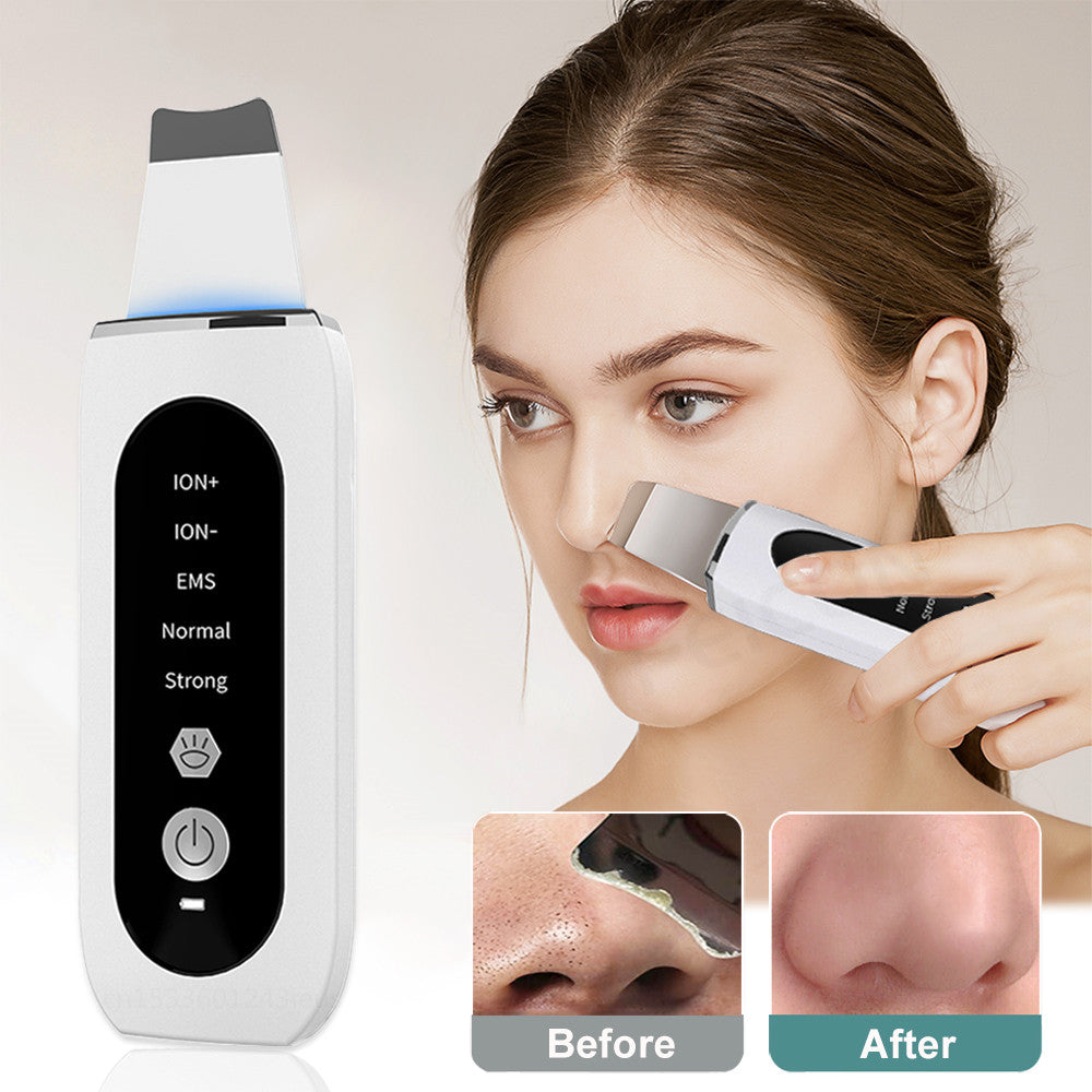 Ultrasonic Skin Scrubber Blackhead Remover Deep Face Cleaning