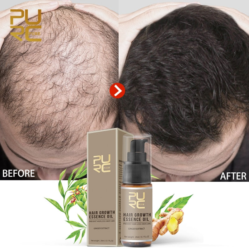 Hair Growth Essence Oil Hair Loss Treatment